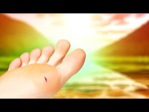 Giải mã giấc mơ thấy chảy máu chân